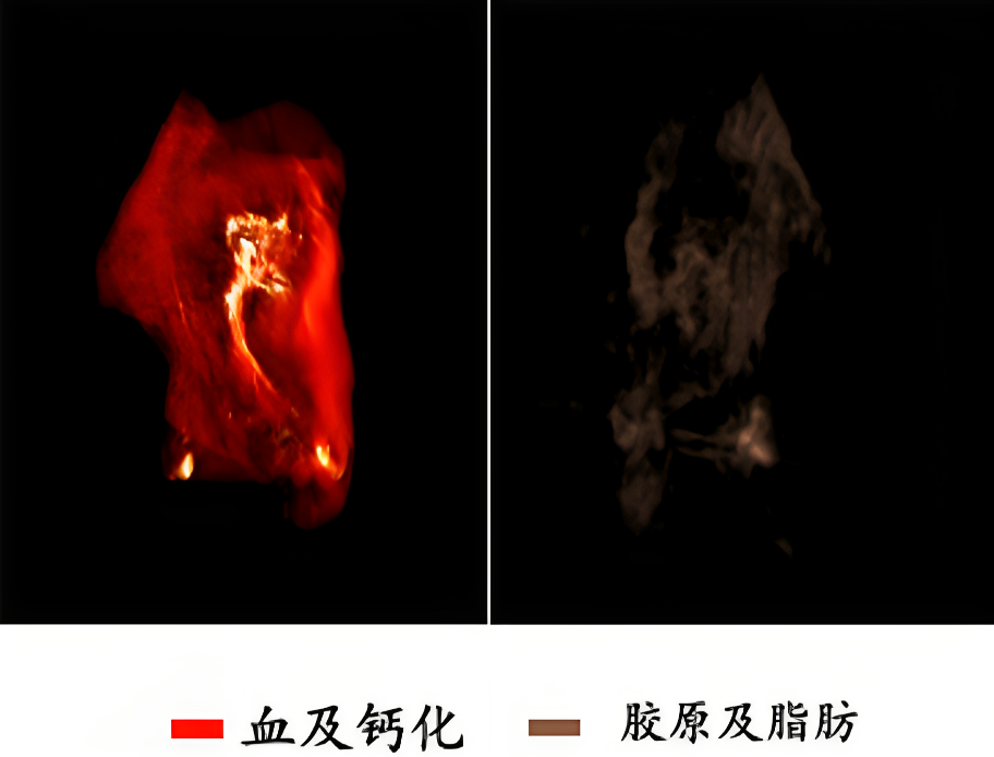 小鼠全身三维光声成像