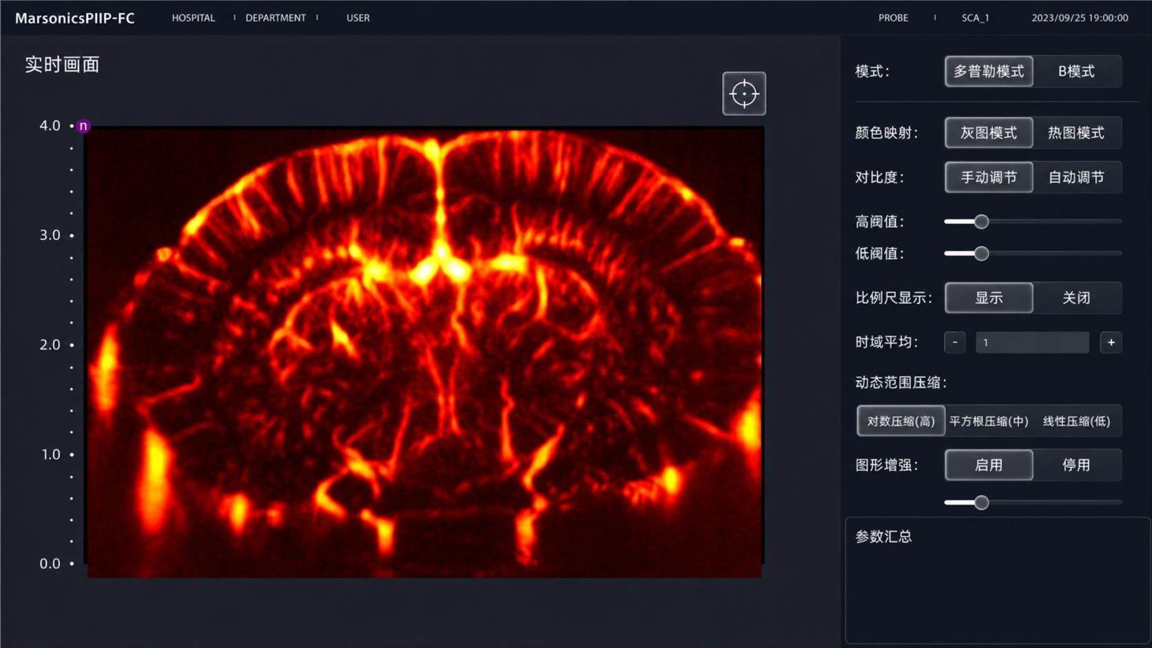 USP RT 实时功能超声成像平台软件界面